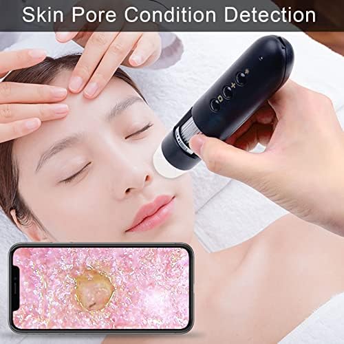 Connect 500X Scalp Detector for Hair Health, Skin Hair Diagnosis Analyzing High Definition Electronic Microscope Scalp Follicle Detector