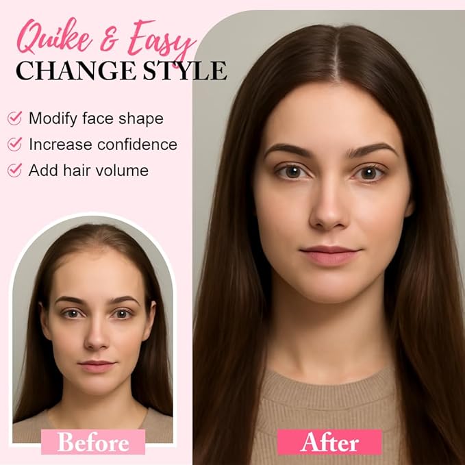 Hair Toppers for Women Real Human Hair Topper for Women with No Bangs Hairpieces Comfortable and Breathable 10 Inch Swiss Base 3D 360°Cover Glue-free and Shedding Free (Natural Black)