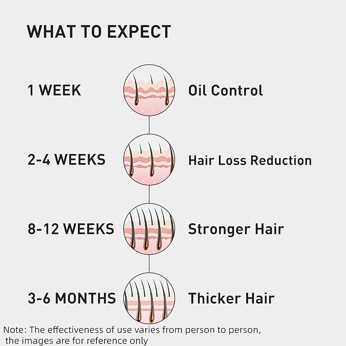 0.9% KX-826 KINTOR Hair Growth Spray,Strengthen Hair Nourish Hair follicles,Hair Care Products for Sparse Hair and Oily Hair Men&Women,300ml,Pro
