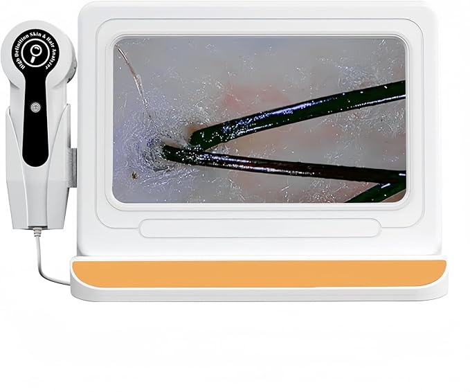 Professional Scalp Camera with 11-Inch HD Screen - High-Definition Hair & Scalp Analysis Device for Salons and Spas, Easy to Use, Ideal for Scalp Care & Client Consultations