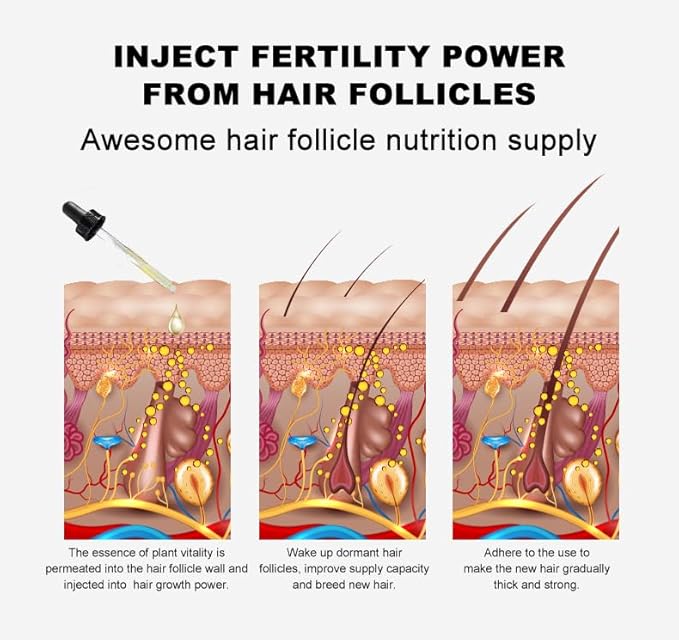 Vedora Ginger Oil for Hair Growth - Promotes Strong, Thick, Long Hair with Essential Ginger Serum - For Men & Women - 5.25 Fl Oz / 150ML (5pc)