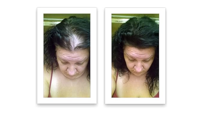 Hair Powder For Thinning Hair. Makes Thin Hair Look 10X Fuller, Covers Bald Spot Instantly. All-Natural Hair Building Fiber. Trial Size (10-Day Supply). Black