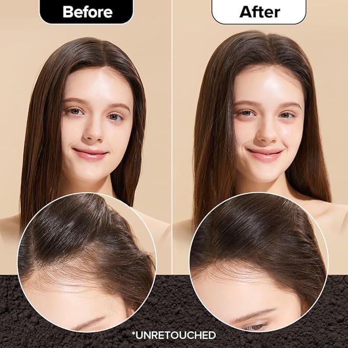 I DEW CARE Biotin Clarifying Dry Shampoo - Tap Secret Dark Brown | Strengthening & Volumizing, Powder Type, Refillable, Travel size, Non-aerosol, Brunette, Korean Ginseng, 0.24 oz