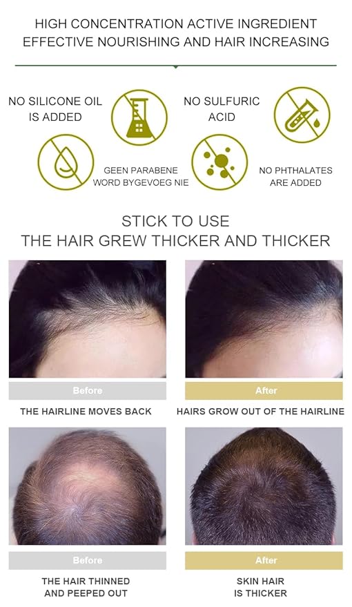 Vedora King of Ginger Oil for Hair Growth - Biotin Hair Growth Serum, 100% Pure Natural Ginger Essential Oil - Promotes Stronger, Thicker, Longer Hair in Women & Men - 3.15 Fl Oz / 90ML (3 PCS)