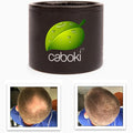 Quick Fix For Thinning Hair and Bald Spot. Get 10X Fuller Hair Instantly. All-Natural Hair Building Fiber For Hair. Trial Size (10-Day Supply). Light Brown
