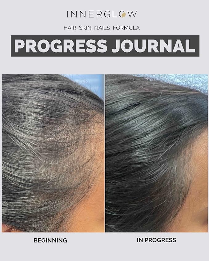 Advanced Hair, Skin & Nails Vitamins – Doctor-Developed Hair Supplement with Biotin, Collagen Peptides, Vitamin E & B12 – Clinically Tested 12-Week Results, Made in USA, Non-GMO