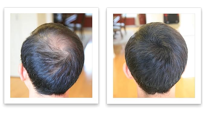 Caboki Hair Volumizer: Root Touch Up, Cover Thinning Hair, Bald Spots & Gray Roots, TALC-Free, For Men & Women, Medium Brown