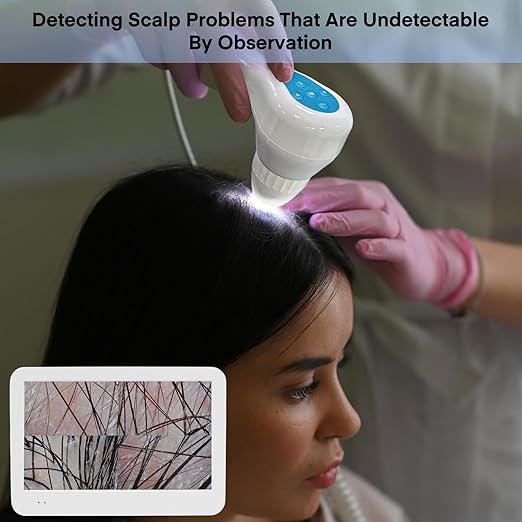 Beauty Star Scalp Analysis Machine, 12 inches Skin Tester Diagnosis Digital Analyzer Tool, Profesional Hair Detector Microscope, HairFollicle Health Detection Camera for Head Spa, Salon and Home Use