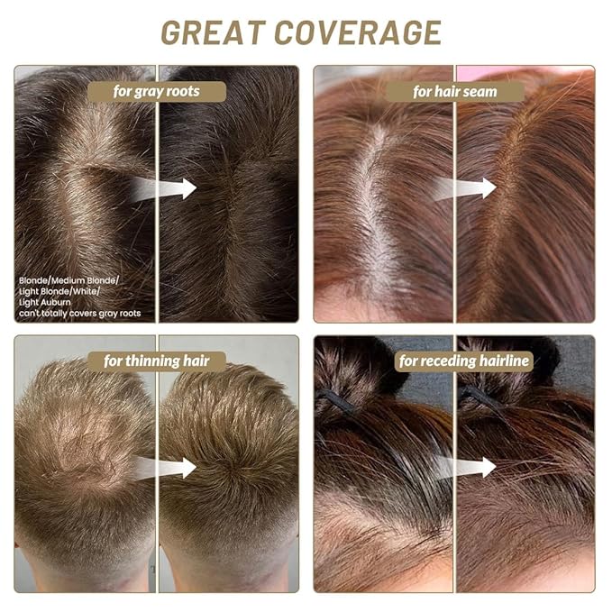 SOVONCARE Hairline Powder - Root Touch Up & Gray Hair Concealer for Men and Women, Instantly Covers Thinning Hair and Bald Spots, Natural-Looking Coverage Medium Blonde 0.35 oz