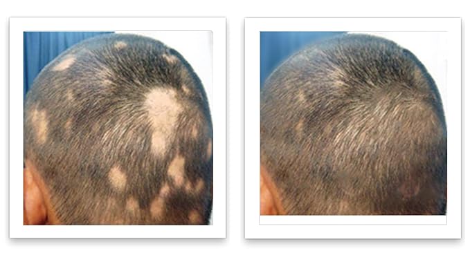 Caboki Hair Volumizer: Root Touch Up, Fill in Hairline & Edges, Cover Thinning, Bald Spots, and Gray Hair - Talc-Free, Healthful Powder for Men and Women. Blonde