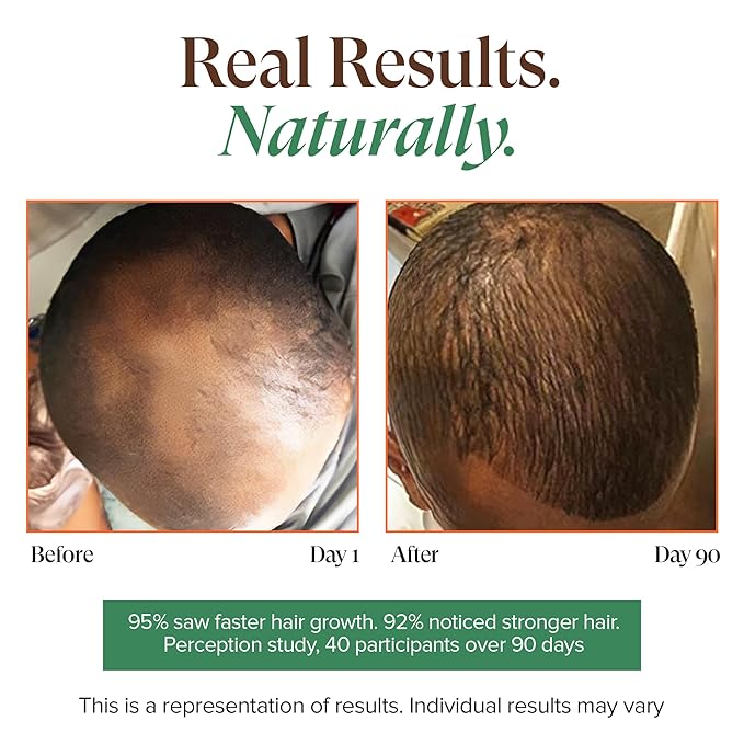 Kreyol Essence - Haitian Black Castor Oil for Skin and Hair, Glass Bottle - Cold Pressed, Hexane Free, Fuller-Looking Hair, Natural Humectant, Mango Papaya & Coconut, 3.4 Fl Oz