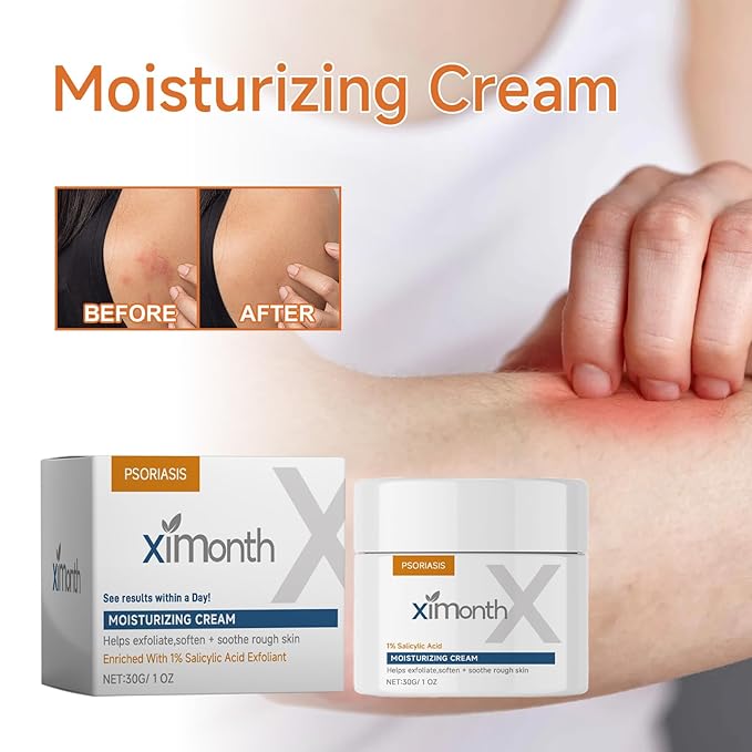Psoriasis Relief Cream with Salicylic Acid, Bee Venom, Aloe Vera and Peppermint Extract, Soothing Moisturizing Treatment for Dry and Itchy Skin Care, 1 Oz