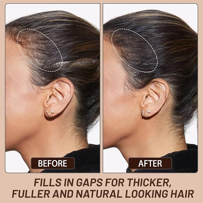 VOLLUCK Root Touch up Powder, Instant Hairline Powder for Thinning Areas and Gray Hair Coverage, Natural and Non-greasy Root Cover up for Women and Men (Medium Brown, 0.35 Ounce)