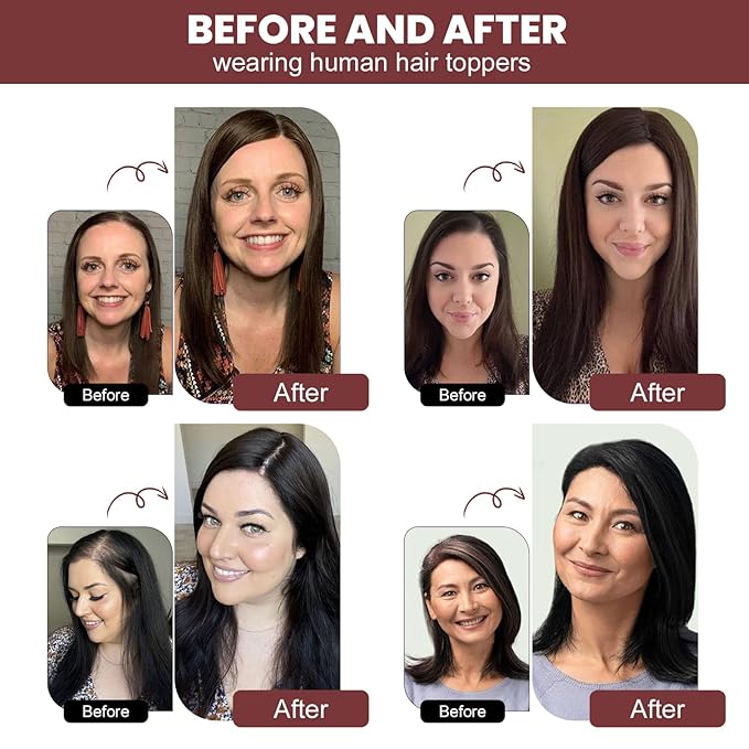 YAMI Hair Toppers for Women Real Human Hair, Human Hair Topper with Swiss Base Hairpieces for Women with Thinning Hair 12 Inch 40g - Medium Brown