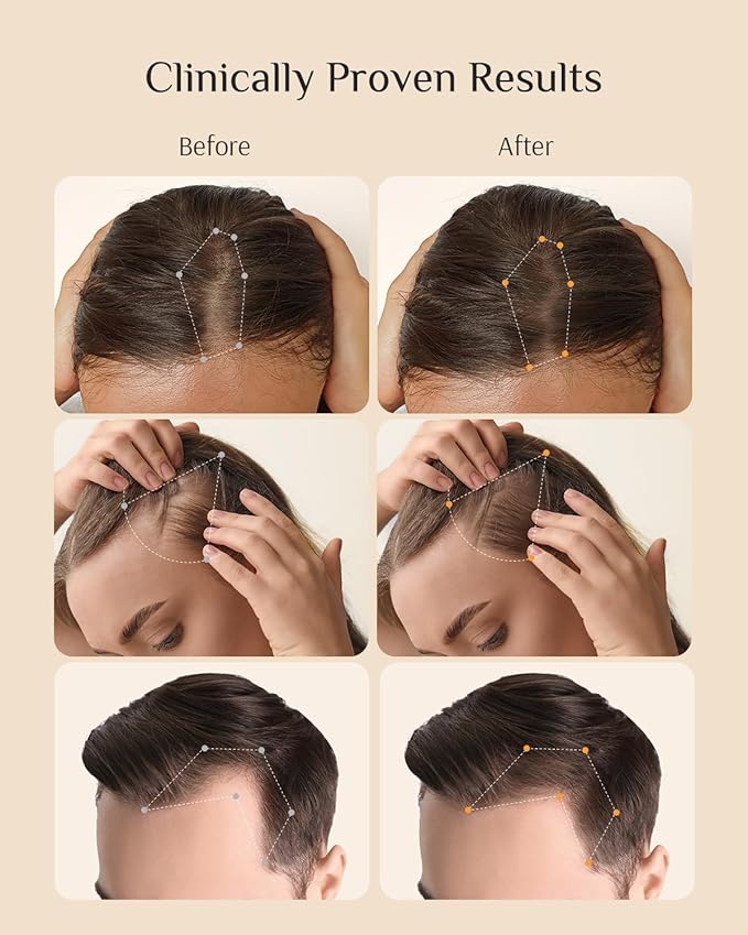DR ZERO NEOLOGY Hair Growth Shampoo for Women, 13.5 oz/400ml, Volumizing Thickening & Anti Hair Loss Regrowth Treatment, Clinically Tested for Hair Thinning with Redensyl, Japanese Hair Care Products