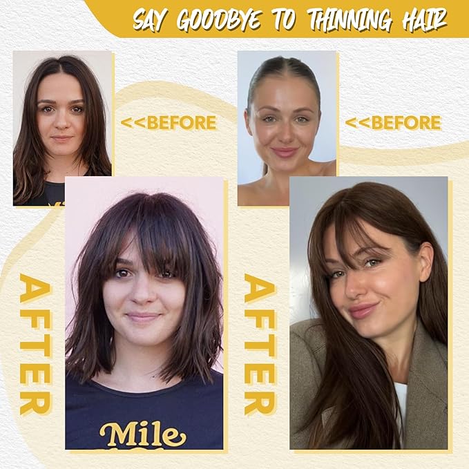 10inch Hair Toppers for Women Clip in Bangs with Thinning Hair Pieces for Women Medium Brown Hairr Topper for Woman 4.4 * 3.1’ Wiglets Hairpieces for Thinning Hairs#4