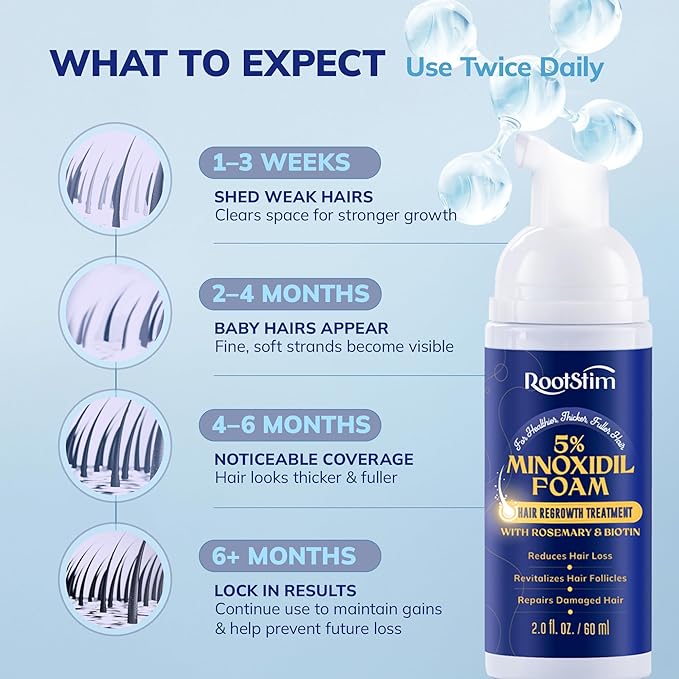 5% Minoxidil Foam for men and women, Extra Strength Hair Regrowth Treatment for Thinning Hair and Hair Loss, Hair Follicle Health – Thicker, Fuller Hair Growth Solution 6 FL.OZ