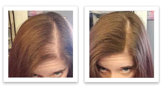 Hair Building Fiber. Cover Bald Spot and Thinning Hair Instantly. 10X Fuller Hair. All-Natural, Organic Hair Loss Concealer. Trial Size (10-Day Supply). Medium Brown