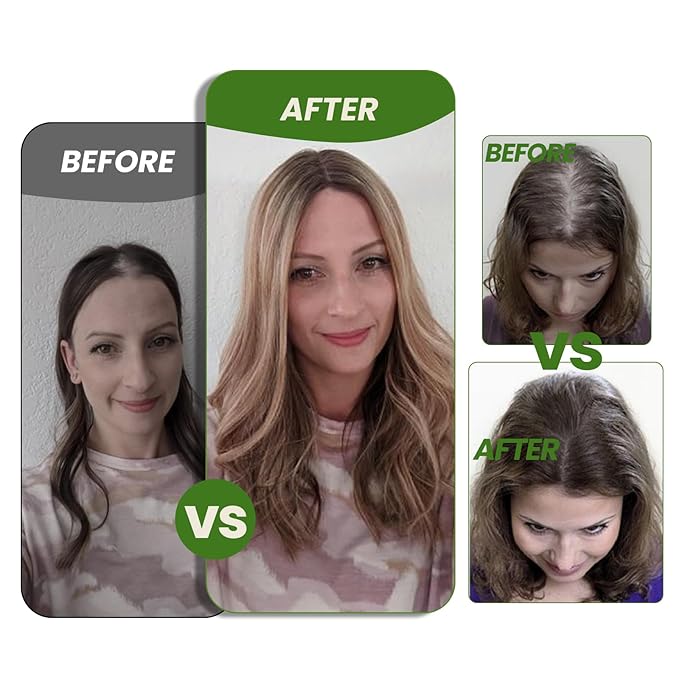 HAIR Toppers for Women Real Human Hair 6x7 inch 150 Density Base 16 inch 75 grams darkest brown Human Hair Topper for Women with Thinning Hair(#2 16inch)