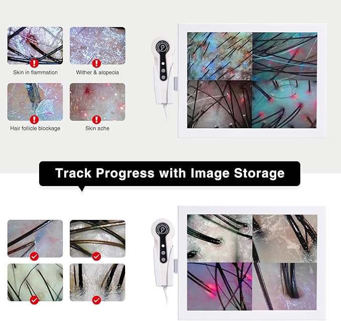 Professional 15-Inch Scalp Camera for Beauty Salons – High-Resolution Hair and Scalp Analysis Device with Image Storage, Easy Assembly, Durable Build, Ideal for Client Consultations & Head Spa