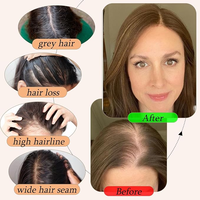 Human Hair Toppers for Women with Thinning Hair Real Human Topper Crown No Bangs 10 Inch #1 Black