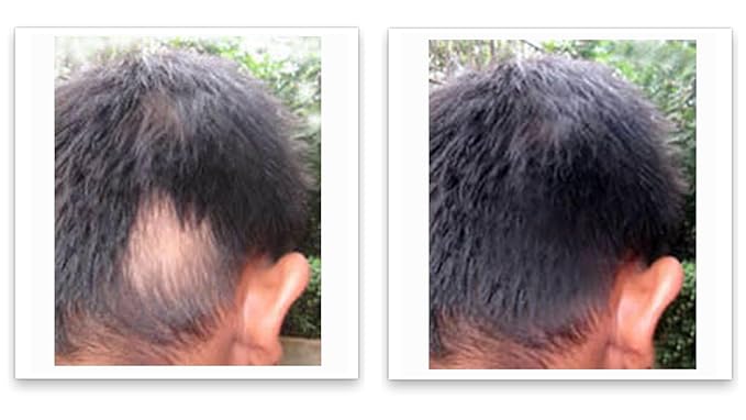 Caboki Root Touch Up Hair Volumizer: Fill in Hairline & Edges, Cover Thinning, Hair Loss, Bald Spots & Gray. TALC-Free, Healthful Men Women Light