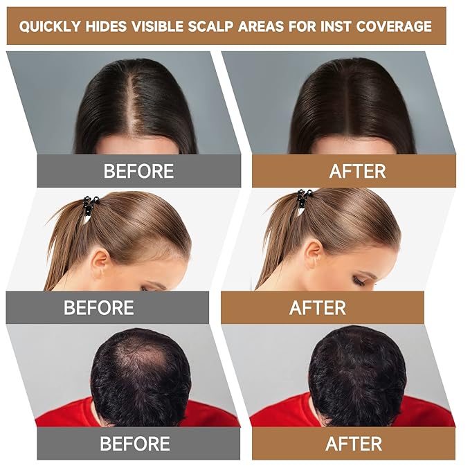 Root Touch Up Powder, Instantly Gray Hair Cover Up, Women Color Root Coverage Shadow Powder for Thinning Grey Hairline, Men Roots Concealer for Hair Loss Beard Line Eyebrow, Medium Brown