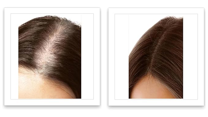 Caboki Thinning Hair Powder for Root Touch Up, Cover Gray & Fill in Hairline Loss, Edges . TALC-Free, Healthful Powder Volumizer for Men and Women. Silver White