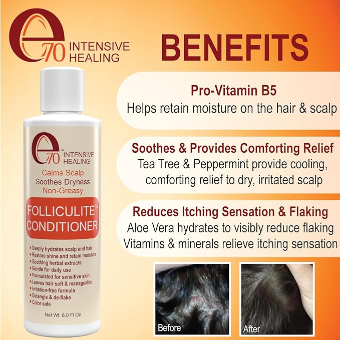 Folliculitis Treatment Conditioner with 3% BHA, Salicylic Acid, Tea Tree Oil & Chamomile Extracts - Anti Itch for women & men with Irritated Flaky Scalp Acne Treatment, Made in USA by e70, 8 fl oz