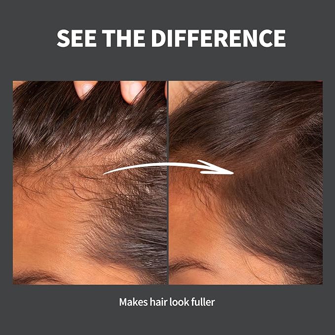 Hairline Powder 24H Stain-Proof, Root Touch Up Hair Color for Gray Coverage,Bald Spot Concealing Hair Shadow Powder for Women & Men,Natural-Looking (Brown)