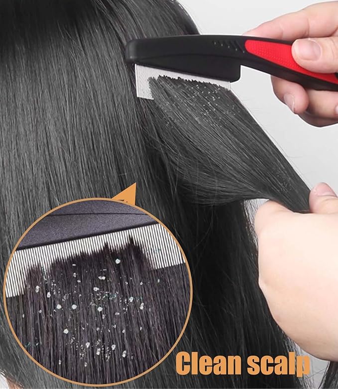 Dandruff Comb Fine Tooth Scalp Detox Comb Lice for Women, Men & Kids Stainless Steel Scalp Detoxing, Sweep & Massage Hair Brush Tool for Hair Care (Brown+Red)