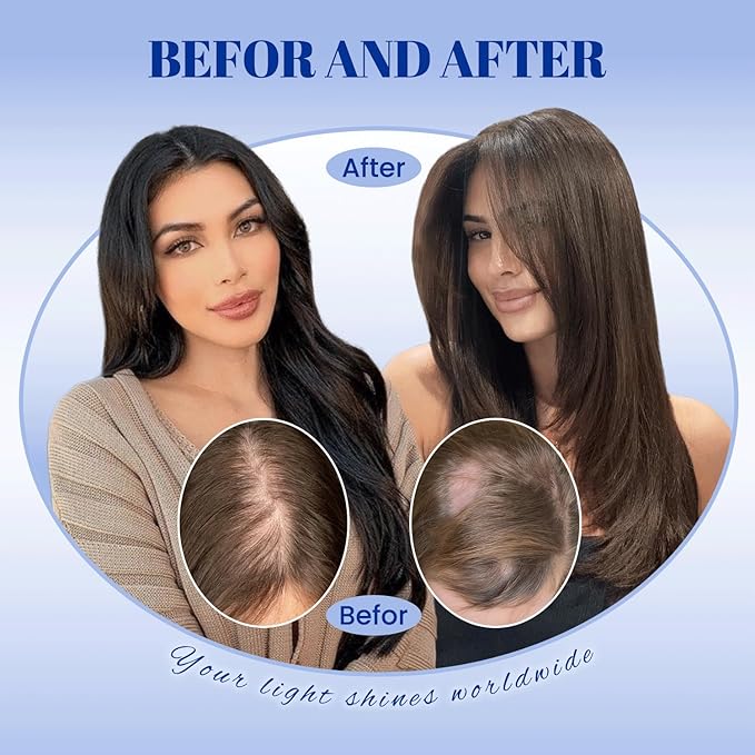 WORLDSTAR Hair Topper for Women Real Human Hair 360°3D Coverage Hairpieces Hand-stitched, No Bangs,75g,6 * 7 Inch Base,16 Inch #4 Medium Brown with Top Extension for Thinning Hair (tp#4-16)