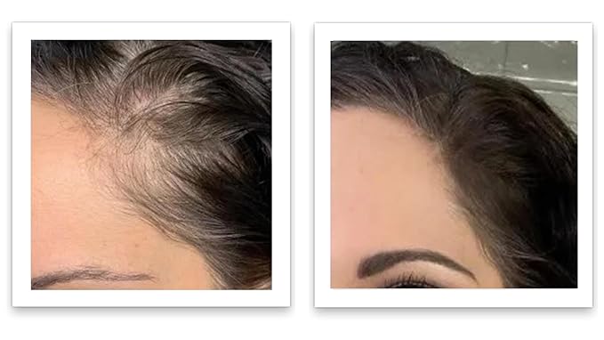 Caboki Root Touch Up Hair Volumizer: Fill in Hairline & Edges, Cover Thinning, Hair Loss, Bald Spots & Gray. TALC-Free, Healthful Men Women Light