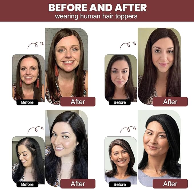 YAMI Hair Toppers for Women 100% Real Human Hair Toppers for Women 12Inch Large Upgrade Swiss Base Cover Hairloss and Add Volume (Ombre Brown with Blond Highlight)