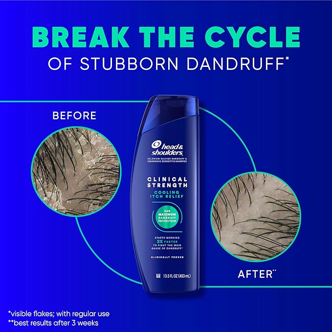 Head & Shoulders Anti-Dandruff Shampoo, Clinical Strength Intensive Itch Relief Twin Pack, 1% Selenium Sulfide, Seborrheic Dermatitis Relief, Itch Relief, 13.5 fl oz Each