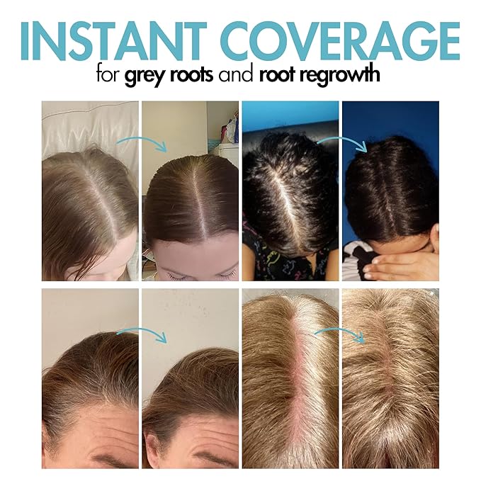 Hair Genetics Root Cover Up Hide Your Grey Hairs Roots NEW Mineral Powder Technology Natural looking Results in Seconds Root Touch Up Powder (Dark Brown)
