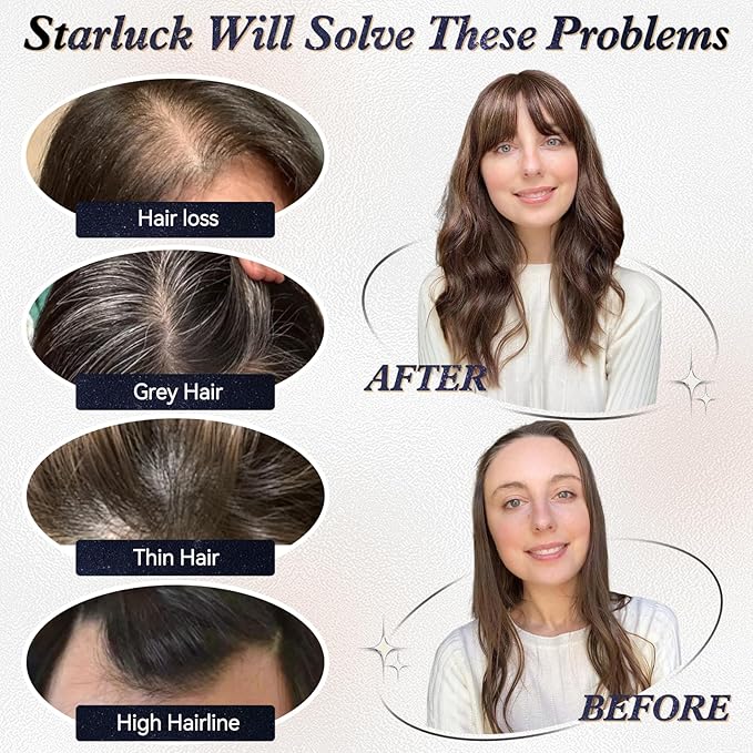 starluck Hair Toppers for Women Real Human Hair No Bangs, 100% Remy HumanHair Toppers for Women Hand-woven with Thinning,Cover Gray Roots,Adds Volume,Ombre Ash Blonde