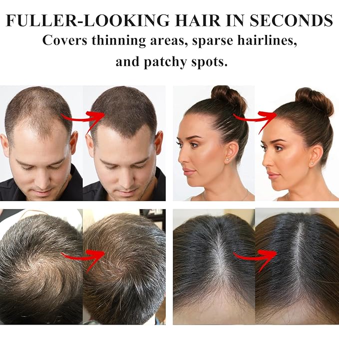 VOLLUCK Root Touch up Powder, Instant Hairline Powder for Thinning Areas and Gray Hair Coverage, Natural and Non-greasy Root Cover up for Women and Men (Blonde, 0.35 Ounce)