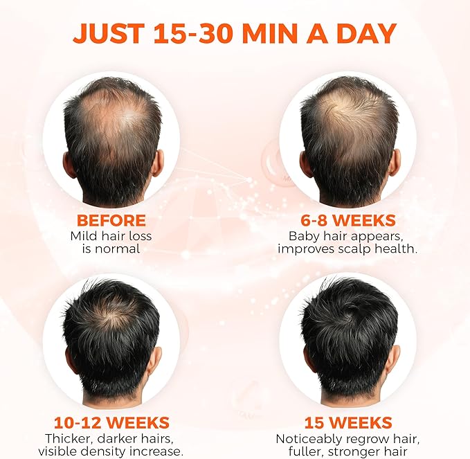 Red Light Therapy Baseball Cap for Hair Growth- Cord Free and Rechargeable Red Light Therapy Cap - Wireless Red Light Therapy Hat