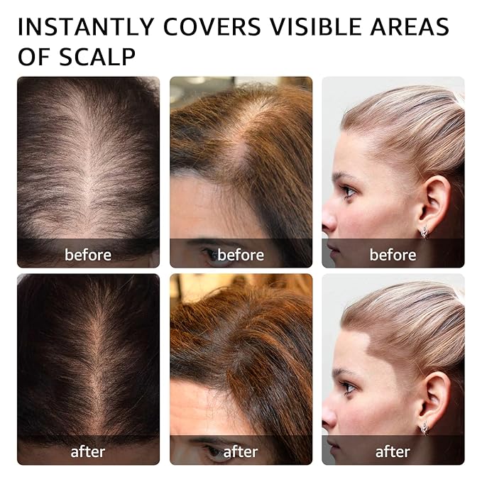 Root Touch Up Hair Color For Concealing Hair Loss and Thinning, Gray Hair Shadow Root Cover Up Hairline Powder For Women Men Eyebrows, Beard Line (Med Brown)