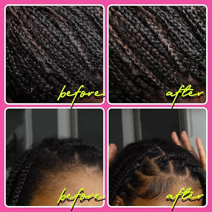 immetee Locks Braid Spray, Hair Frizz Control Spray for Braids, Locks, Twists and Cornrows, Refresh Itchy & Dry Scalp, Moisturizes High Shine for Dull Hair. 150ml/5. 28OZ