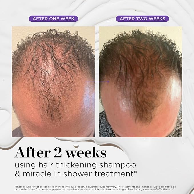 Dr. Groot Miracle in Shower Moisturizing Treatment for Hair Loss, Korean Hair Care Rinse, Rosemary Oil for Smooth, Healthier-Looking Hair in 5 Seconds, Scalp Revitalizing Solution