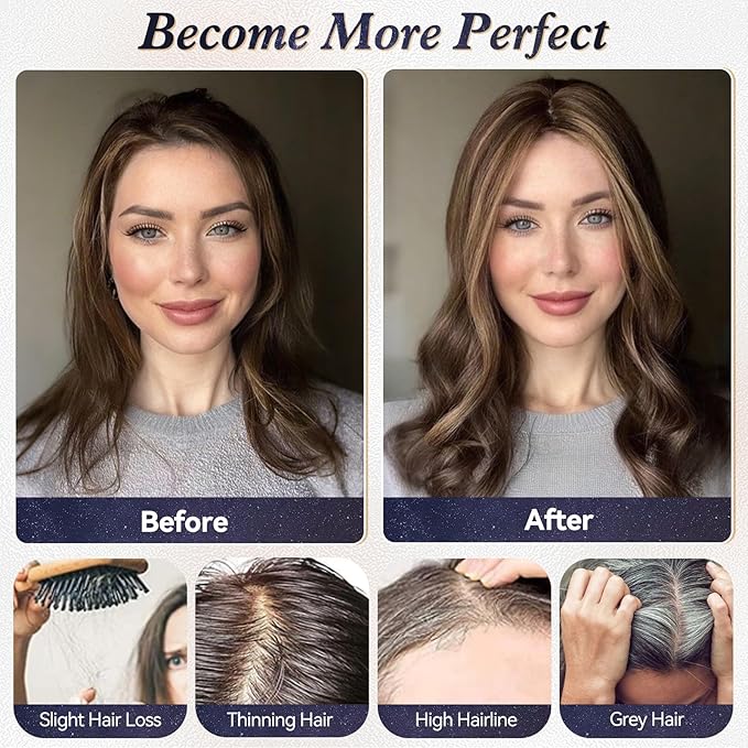 starluck Real Human Hair Toppers for Women 10 Inch Human Hair Topper no Bangs, 3 * 4.5 inches Swiss Base Suitable for ThinningHair Cover Grey Roots(Ash Blonde)