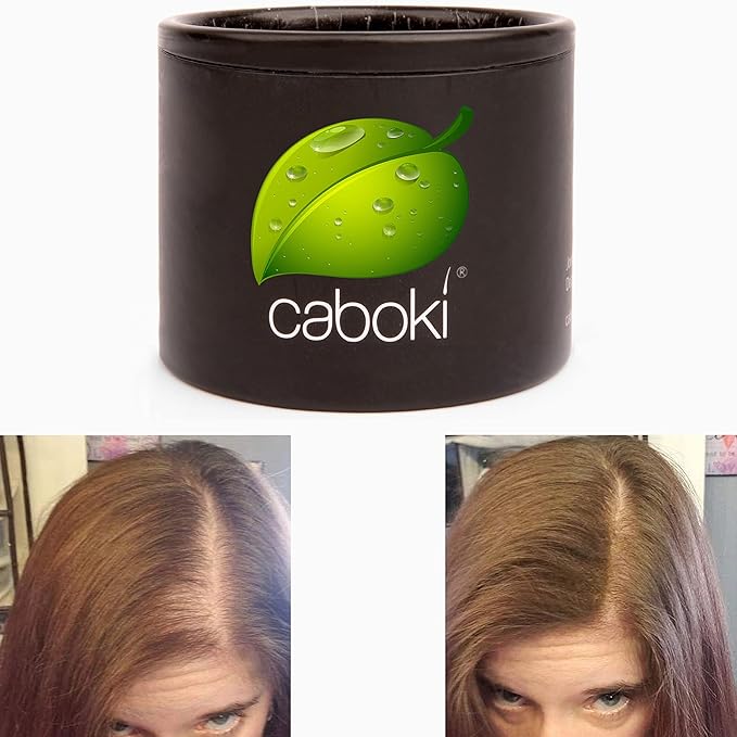 Hair Building Fiber. Cover Bald Spot and Thinning Hair Instantly. 10X Fuller Hair. All-Natural, Organic Hair Loss Concealer. Trial Size (10-Day Supply). Medium Brown
