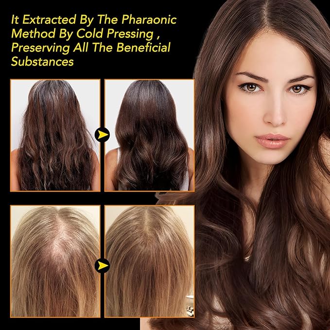 Uocasi Black Seed Oil, Cold Pressed, 100% Pure & Natural , Hair Growth & Skin Care, 2.02 Fl Oz