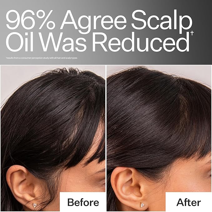 Act+Acre Cold Processed 4% Niacinamide Oily Scalp Serum | Reduces Oil & Odor | Fermented Green Tea + Astragalus | Extends Time Between Washes | Vegan, Fragrance-Free | 2.2 Fl Oz