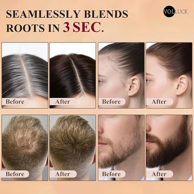 VOLLUCK Hairline Powder Instantly, Root Touch up Powder Hair Color Upgraded, Grey Root Cover up Conceals Hair Loss, Hairline Shadow for Women & Men for Thinning Hair Natural, Sweatproof (Med Blonde)