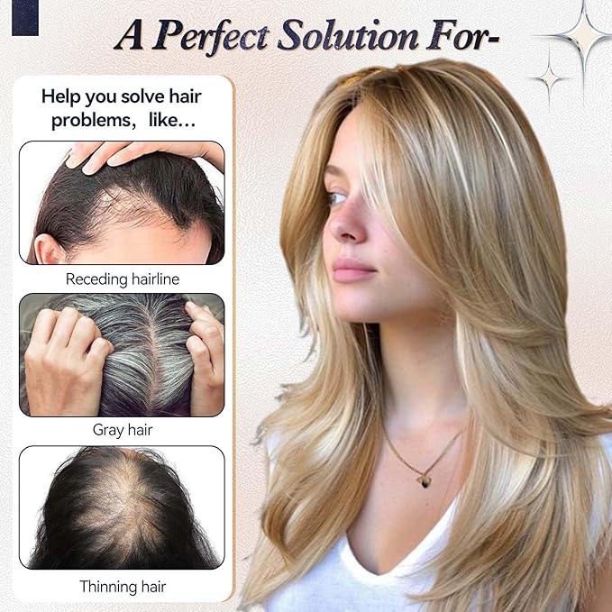 starluck Human Hair Topper for Women with Thinning Hair, 100% Real Human Hairpiece, 4.6 * 4 Inch Upgrade SilkHug Swiss Lace Base Hairpiece,14 Inch, No Bangs (Ombre Blonde)