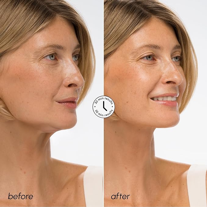 MAREE V Line Lifting Mask with Hyaluronic Acid – Deep Collagen Face Mask for Women – Jawline Shaper Facial Masks with Retinol – Tightening Neck Lift Tape – Double Chin Strap for Face Lift – 10 Masks