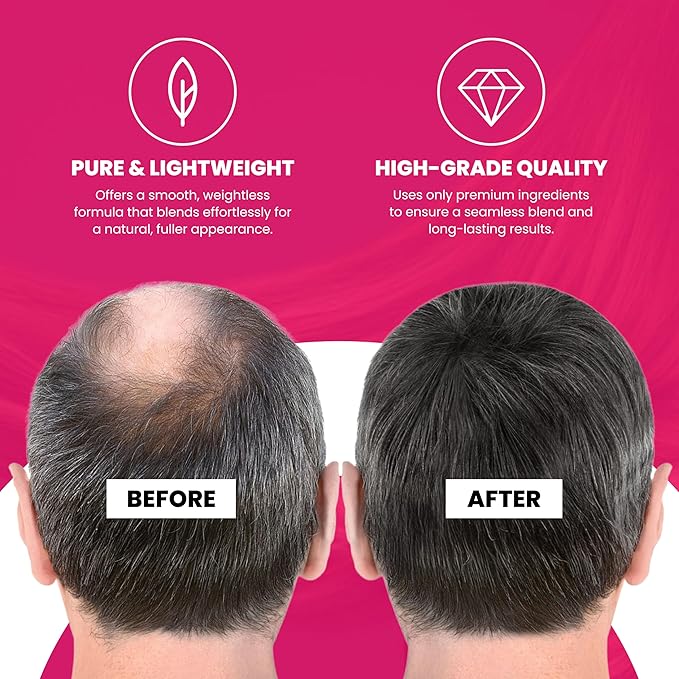 VELO Hairline Powder–LIGHT BROWN Hair Root Touch Up Powder for Women & Men–Instantly Covers Gray Hair, Thinning Hair & Bald Spots–Sweatproof Root Cover Up–Puff & Mirror Compact 13 Shades